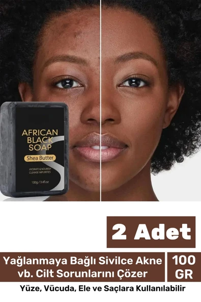 100% Doğal Güzel Kokulu El Yüz Saç Vücut Cilt Onaran Kolajen Etkili Afrika Bitkisel Sabun 2 Adet ürün görseli 1