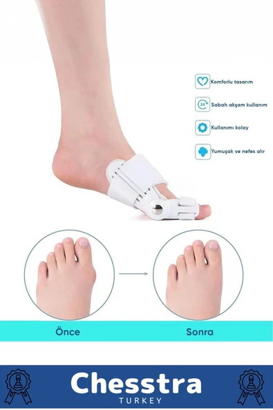 Yumuşak Yıkanabilir Bedensiz Koruma Aparat Sağ Sol Ayak Uyumlu Baş Parmak Kemik Düzeltici 6 Adet - 6