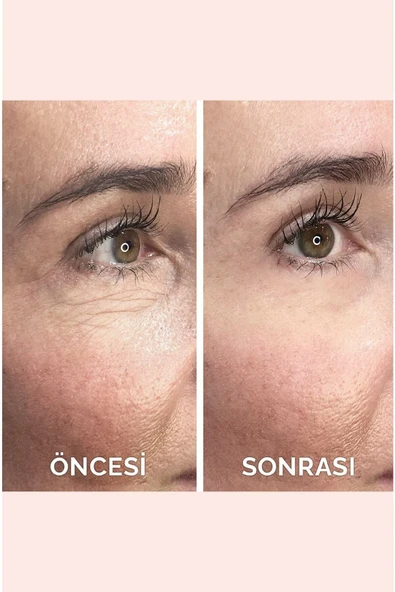 Anlık Etkili Yüz Germe Kremi Göz Altı Torbaları Ve Kırışıklık Karşıtı %10 Acetly Hexapeptide-8 (7ml) - 3