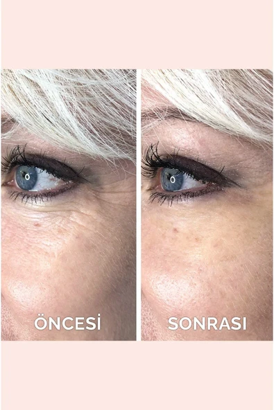 Anlık Etkili Yüz Germe Kremi Göz Altı Torbaları Ve Kırışıklık Karşıtı %10 Acetly Hexapeptide-8 (7ml) - 4