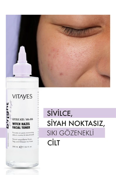 VITAYES C Vitamini Panthenol Cilt Tonu Eşitleyici Leke Karşıtı Serum Ve Akne Karşıtı Cadı Fındığı Yüz Toniği - 2