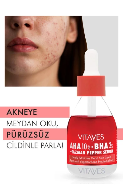 VITAYES Niacinamide %10 Ve Hyalüronik Asit Serumu Aha %10 Bha %2 Kırmızı Peeling Serum Cilt Bakım Seti - 2