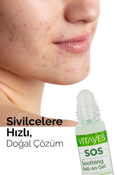 VITAYES Akne Sivilce Siyah Nokta Cilt Problemlerini Onarıcı Doğal Çay Ağacı Özlü Serum 2'li Avantajlı Set - 3