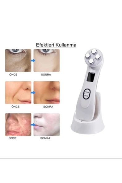 Melistansu Kırışıklık Karşıtı Yüz Germe Cihazı - Resim 3