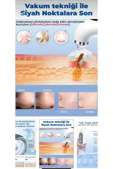 Melistansu Melistansu Hydra Sterilizasyonlu ve Vakumlu Cilt Gözenek Siyah Nokta Akne Sivilce Temizleyici - Resim 2