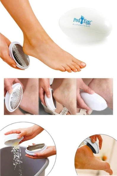 REDSHINE Ped Egg Ayak Tabanı Bakım Törpüsü Topuk Nasır Temizleme Rendesi - 2
