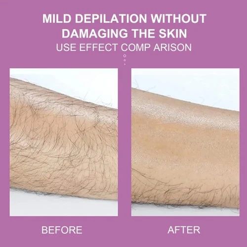 Epilatör Kristal Epilasyon Aleti - Resim 3