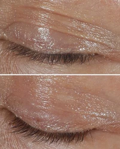 Clinique Smart Clinical Repair Kırışıklık Düzeltici Göz Kremi 15 Ml - 3