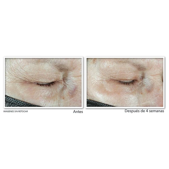 Roc Multi Correxion Hydrate Plump Göz Çevresi Kremi 15ML - 4