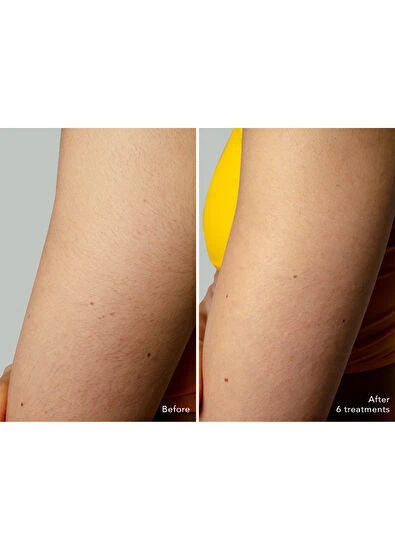 Foreo PEACH 2 go Arctic Blue - Resim 3