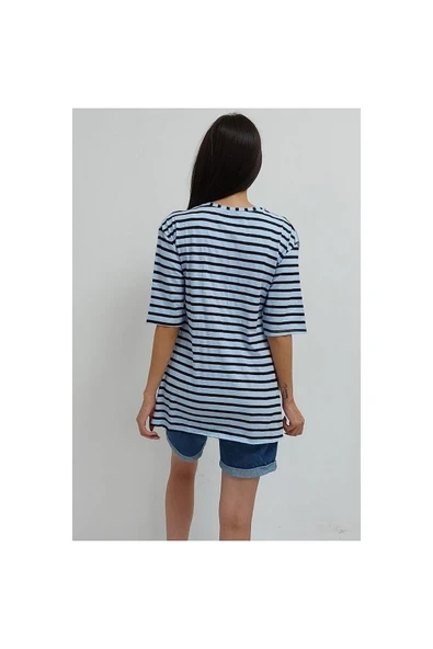 Bkmc Çizgili Yırtmaçlı Tunik Mavi - 5