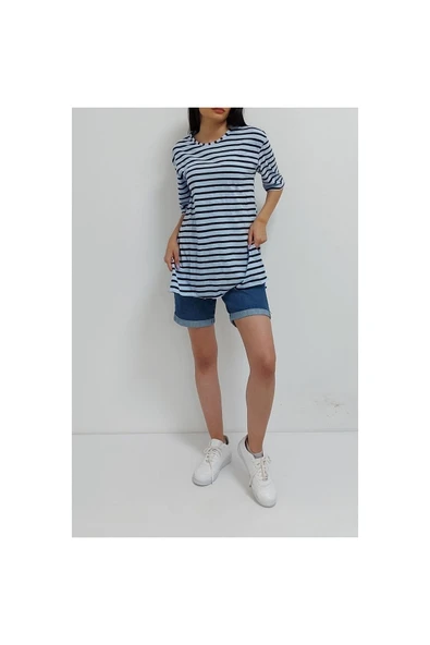 Bkmc Çizgili Yırtmaçlı Tunik Mavi - 2