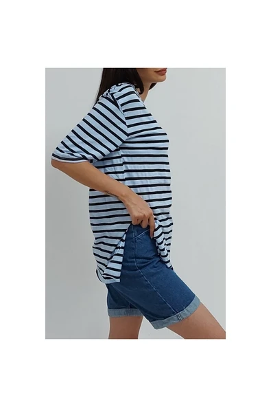 Bkmc Çizgili Yırtmaçlı Tunik Mavi - 3