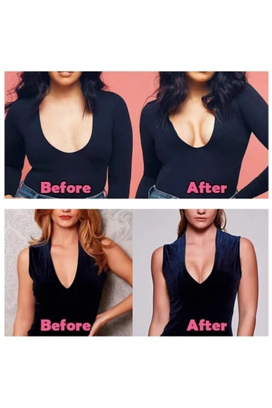 Bkmc Göğüs Dikleştirici Ve Şekillendirici Bant -ten Rengi 5cmx5metre - 3