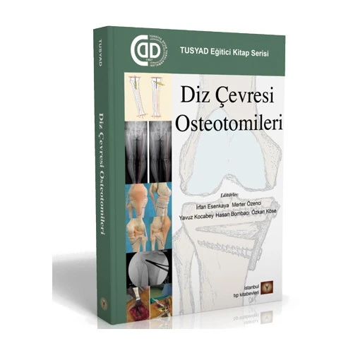 Diz Çevresi Osteotomileri