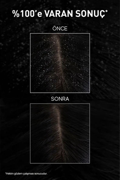 Aqua Thermal Kepek Karşıtı Şampuan 300 ml 2 Adet - Kepek Önleyici - 6