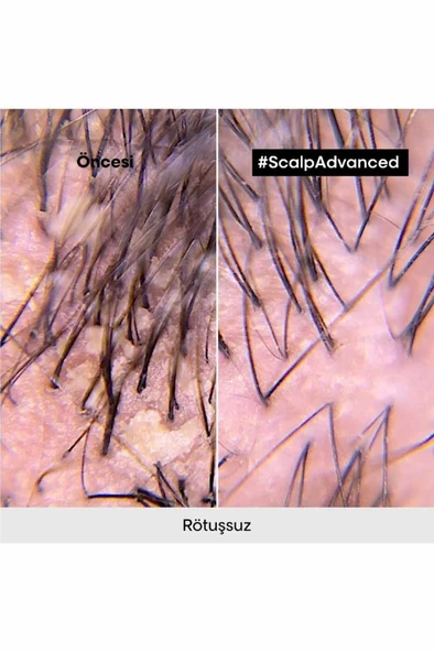Loreal Professionnel Serie Expert Scalp Advanced Kepek Karşıtı Profesyonel Şampuan 500 ml - 6