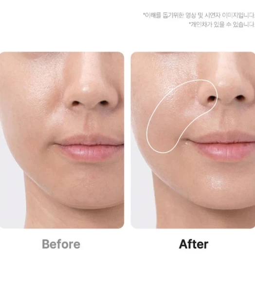 Medicube Beauty Device - AGE-R BOOSTER PRO BLACK (GLOBALCARE) - 3