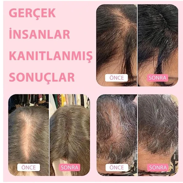 Boldify Saç Dolgunlaştırıcı Fiber Topik Tozu Açık Kahve 28gr - 3
