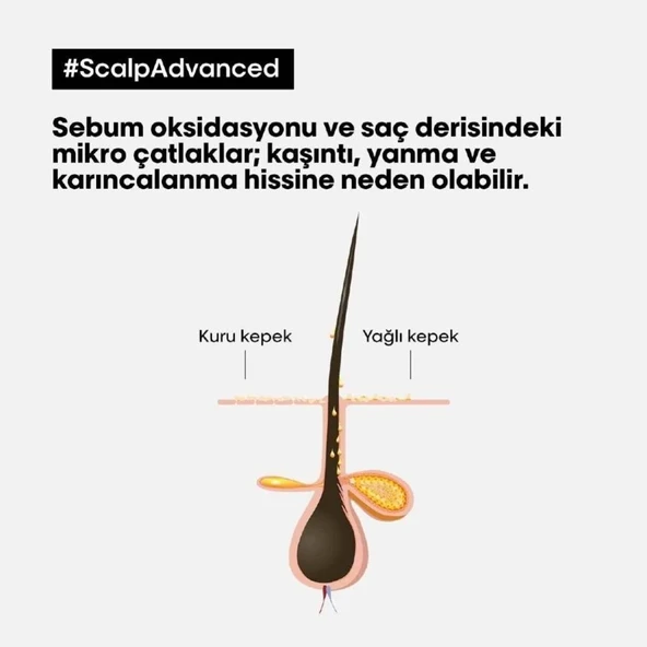 Loreal Professionnel Serie Expert Scalp Advanced Kepek Karşıtı Profesyonel Şampuan 500ml - 3