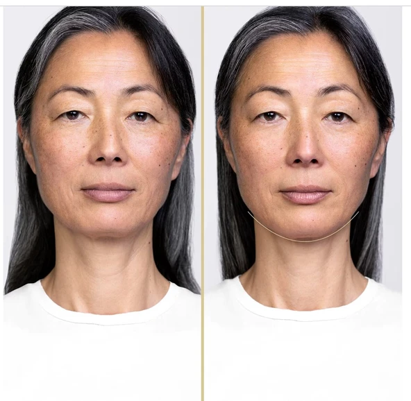 Shiseido  Vital Perfection Night Concentrate - Gece Serumu 40 ml - Resim 2