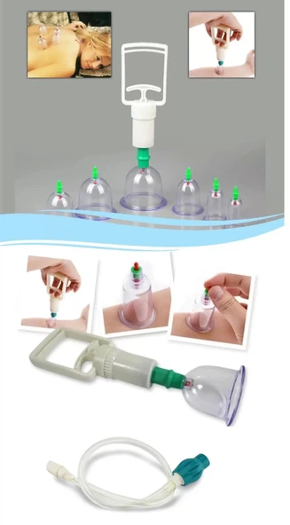 Hacamat Seti Hortumlu - Vakumlu Hortumlu Kupa Çekme Seti (model 2)