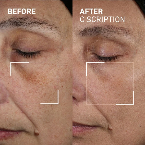 Dr. Brandt Bright This Way C SCRIPTION Serum 30 ml - 2