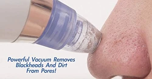 Derma Suction 40 Kpa Vakumlu Siyah Nokta ve Yüz Temizleme Cihazı - 3
