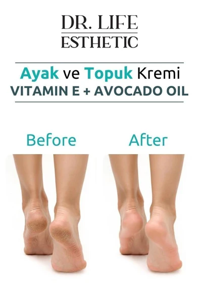 Dr. Life Esthetic Çatlak Onarıcı Ayak ve Topuk Kremi Crack Repair Cream 100 ml - 4