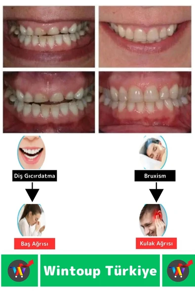 Diş Çene Sıkma Gıcırdatma Bruksizm Önleyici Gece Plağı Koruyucu Uyku Aparatı Protez Kaplı 1 Adet - 2