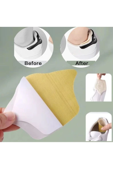 DDTREND Taç Şekilli 5 Mm Topuk Daraltma Ve Vurma Önleyici - 3