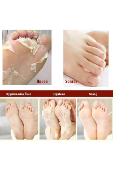 MJCARE Miracle Foot Peeling Pack - Mjcare Çorap Tipi Ayak Peeling Maskesi - 3