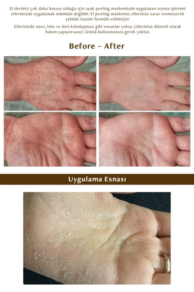 MJCARE Hand Peeling - Soyulan El Peeling Maskesi - 3