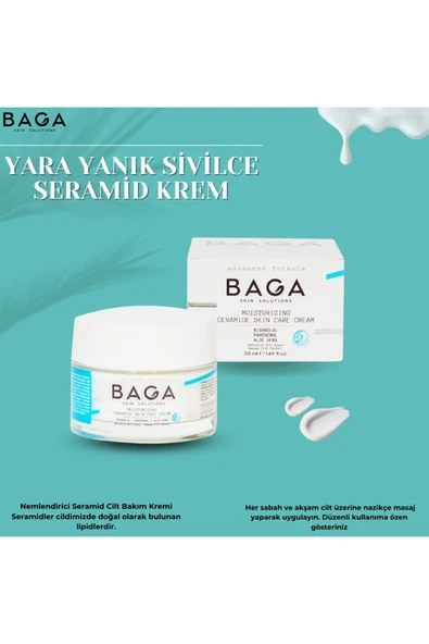 Yara Yanık Sivilce Seramid Krem - 5