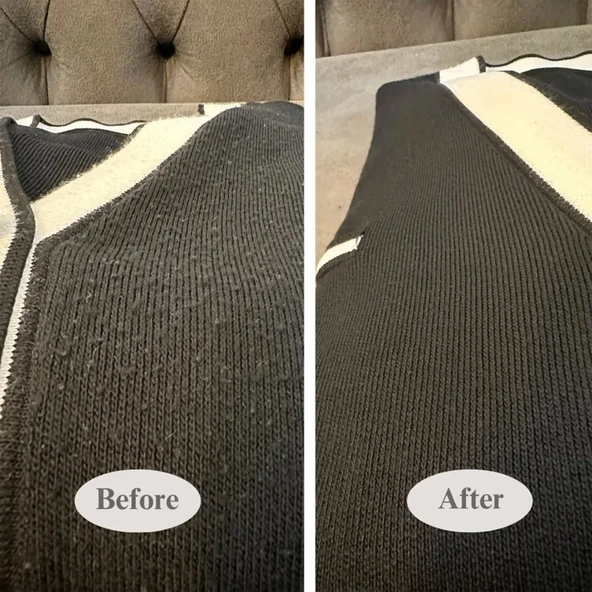 Yui Tüy Toplama Cihazı - 5