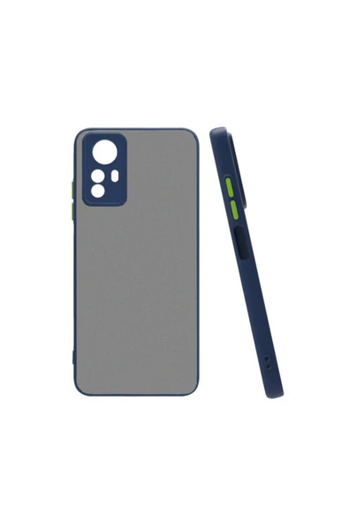 Xiaomi Redmi Note 12S Kılıf Mat Kamera Korumalı Renkli Tuşlu Sert Silikon Kapak (HUX) - Resim 2