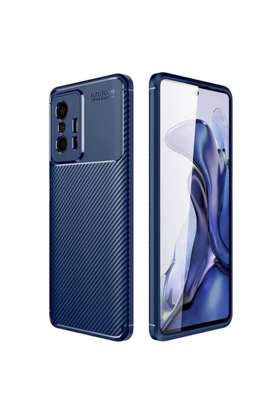Xiaomi Mi 11t Pro 5g Kılıf Kamera Çıkıntılı Karbon Fiber Dokulu Renk Atmaz Kapak (negro) - Resim 5