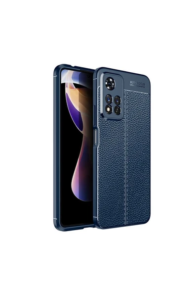 Xiaomi Redmi Note 11 Pro Plus 5g Kılıf Deri Görünümlü Renk Atmayan Dayanaklı Silikon Kapak (niss) - Resim 2