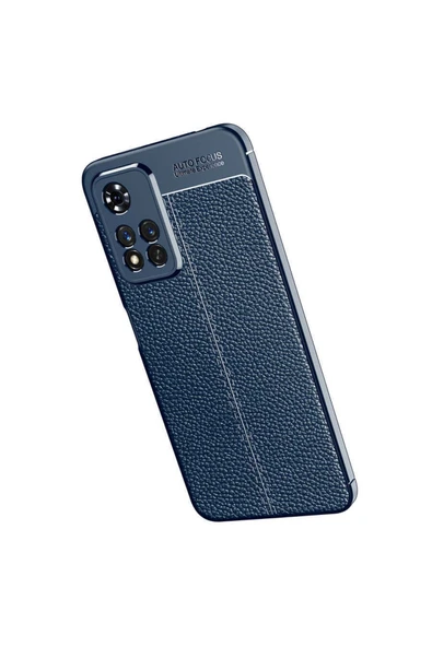 Xiaomi Redmi Note 11 Pro Plus 5g Kılıf Deri Görünümlü Renk Atmayan Dayanaklı Silikon Kapak (niss) - Resim 4