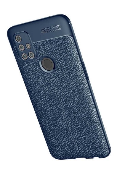 One Plus Nord N10 5g Kılıf Deri Görünümlü Renk Atmayan Dayanaklı Silikon Kapak (niss) - Resim 4