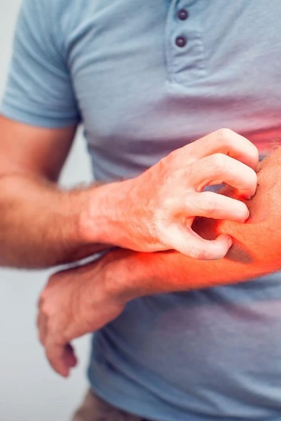 Çay Ağacı Özlü Kükürtlü Kremi (150ML) - 4