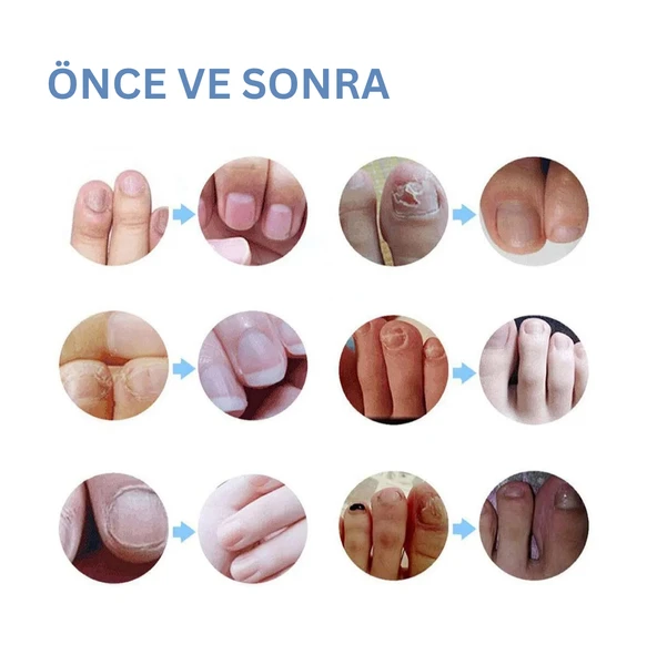 Ariella Bakım Mantarlı Tırnak Tedavi Kalemi, El Ve Ayak Tırnağı Onarım Ve Güçlendirme Seti, Mantar Önleyici - 3