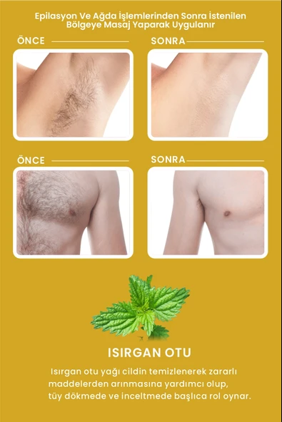 LES VHES Tüy Inceltici Ve Nemlendirici Süt Isırgan Otu & Hyaluronik Asit Özlü 60 ml - 2