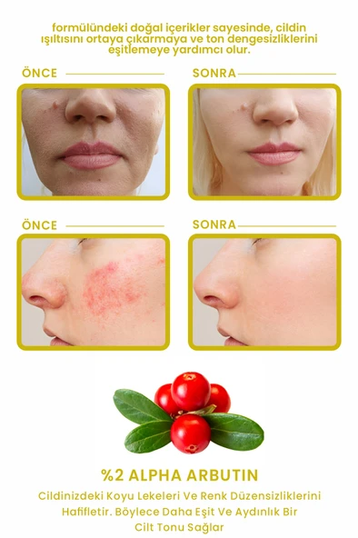 LES VHES Leke Karşıtı ve Cilt Tonu Eşitleyen Cilt Serumu, Glutatyon & Niacinamide Etkili 30ml - 2
