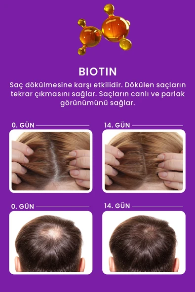 LES VHES Kolajen Ve Keratin Dökülen Ve Geç Uzayan Saçlar Için 11 Aktifli Saç Dökülmesi Karşıtı Şampuan 300 ml - 2