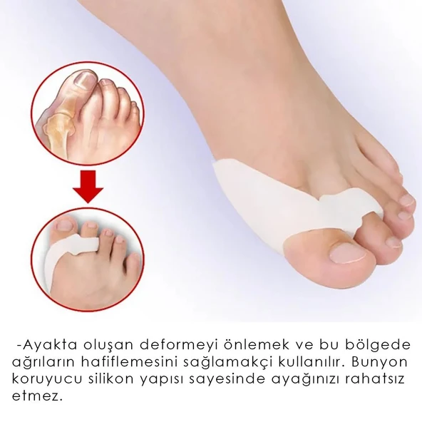 MG07 - Slikon Bunyon Koruma, Baş Parmak Destekleyici Slikon Koruma Pedi, Erkekler ve Kadınlar İçin Yumuşak Parmak Koruyucu Ped - 2