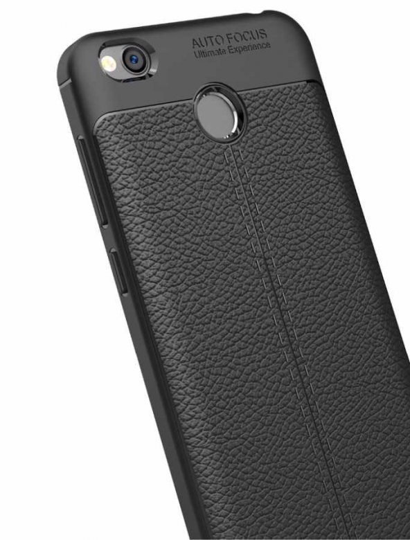 Xiaomi Redmi 4x Kılıf Zore Niss Silikon Kapak - 4