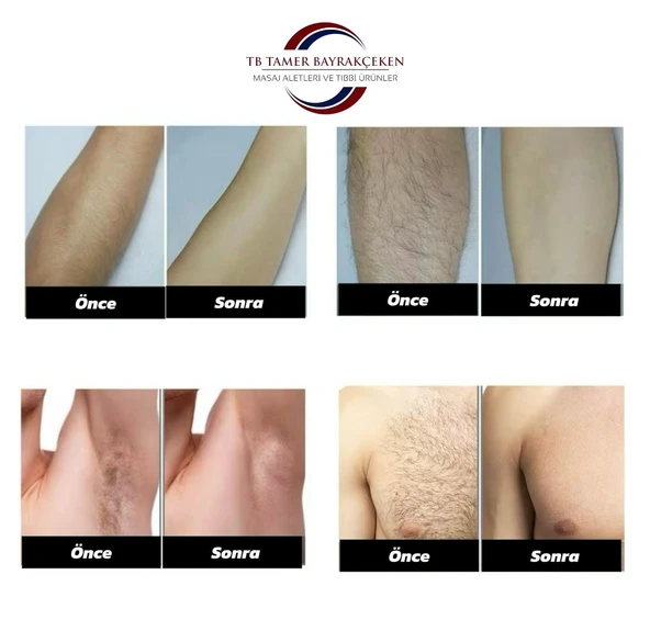 IPL Epilasyon Cihazı - 8