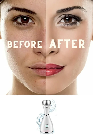 Starcom Nano Iyonik Yüz Nemlendirici Ve Temizleme Cihazı- Derinlemesine Temizlik Ve Gözenek Açıcı (TEŞHİR) - 6