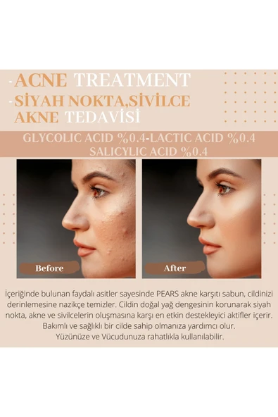 PEARS Original Acne Soap With Glycerine + Gliserinli Siyah Nokta, Akne ve Sivilce Karşıtı Sabun 120g - 4